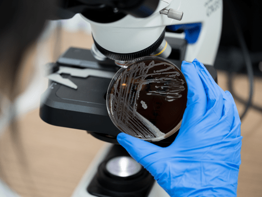Gold standard in antibiotic susceptibility testing is slow